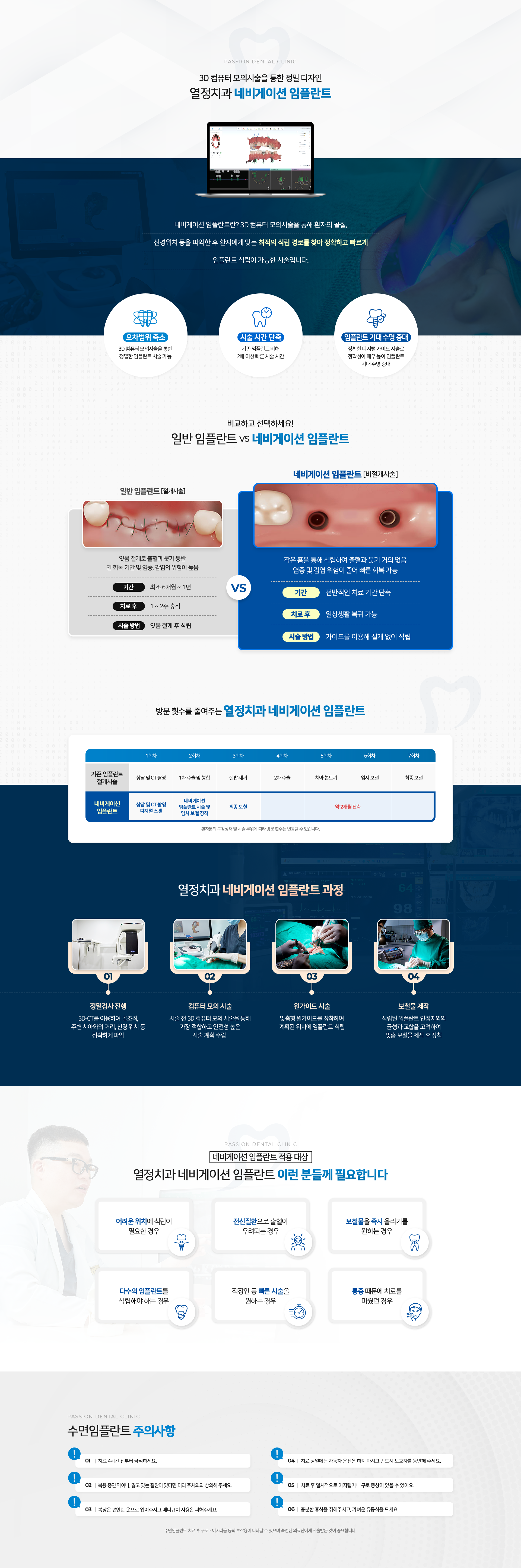 3D 컴퓨터 모의시술을 통한 정밀 디자인 열정치과 네비게이션 임플란트