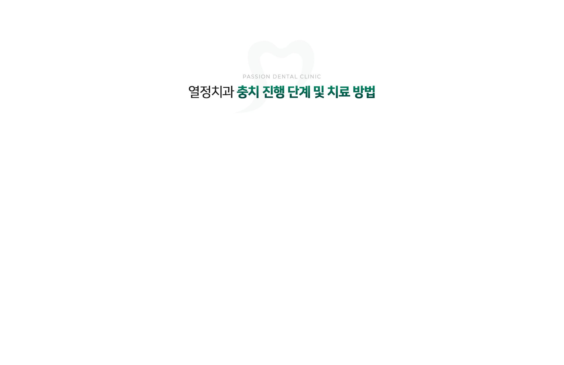 열정치과 충치 진행 단계 및 치료 방법