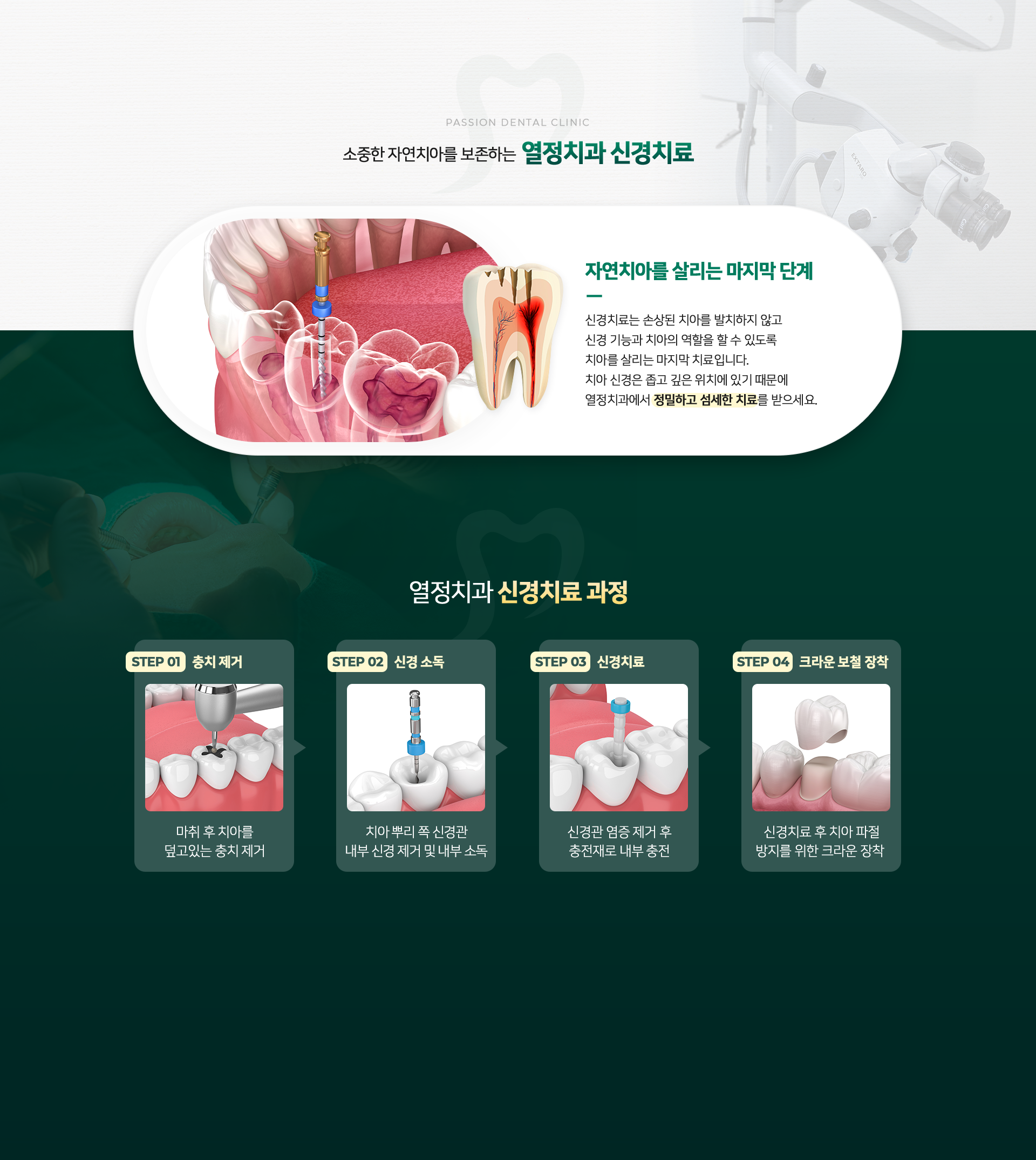 자연치아를 최대한 살리는 열정치과 충치치료