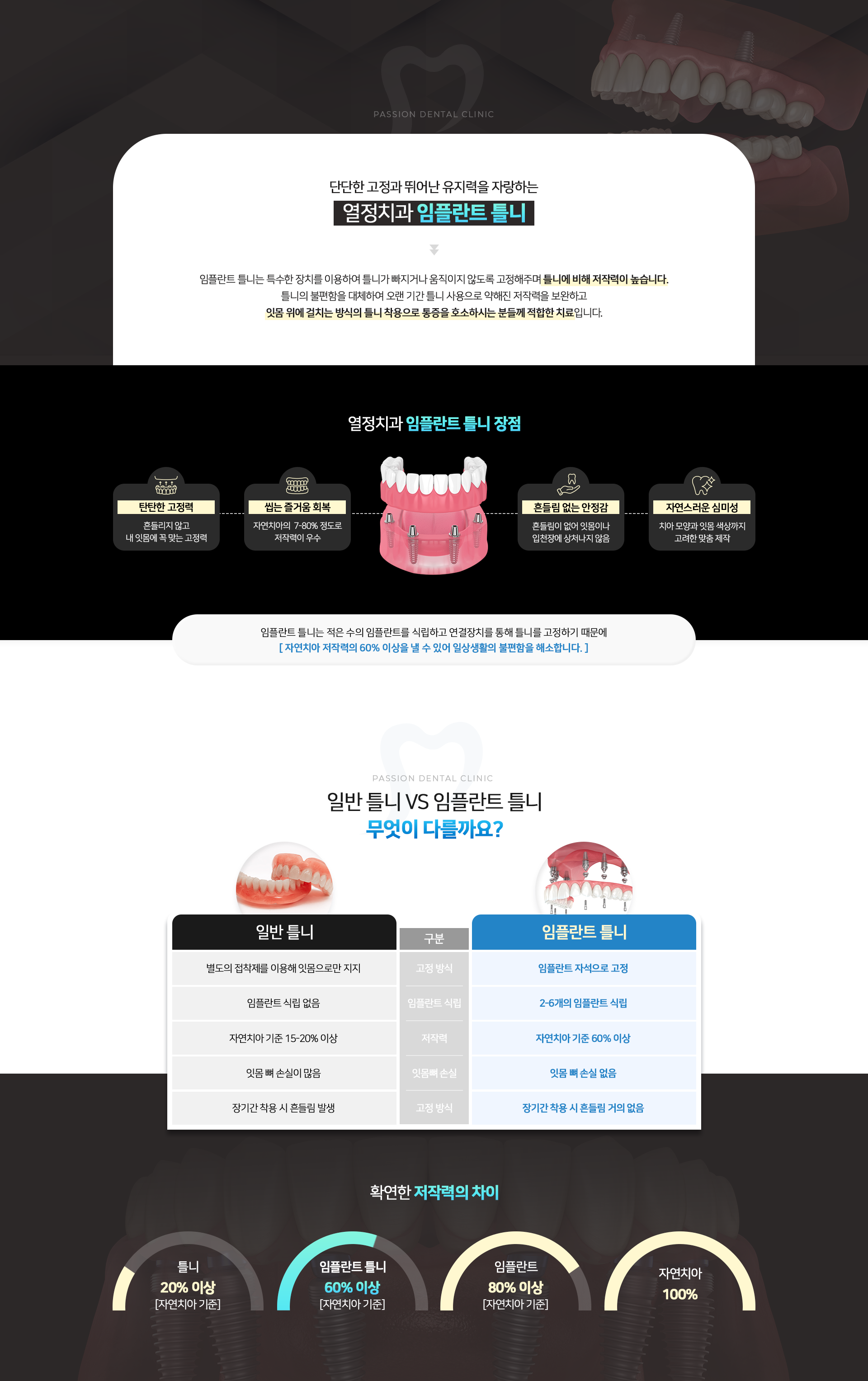 단단한 고정과 뛰어난 유지력을 자랑하는 열정치과 임플란트 틀니